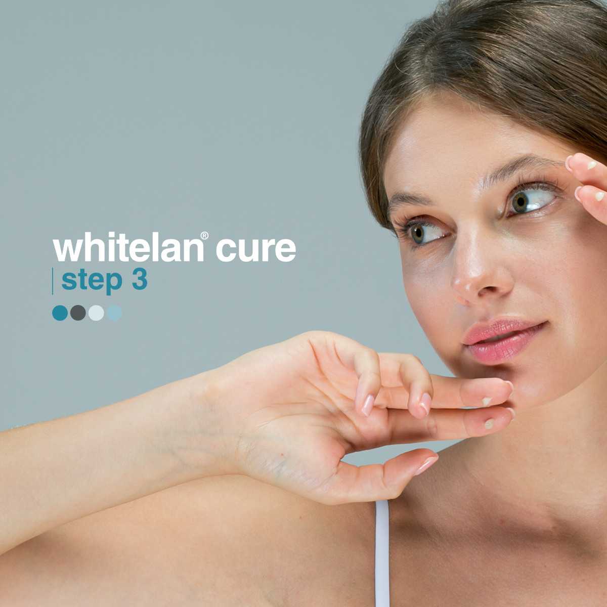 Whitelan Cure | Step 3