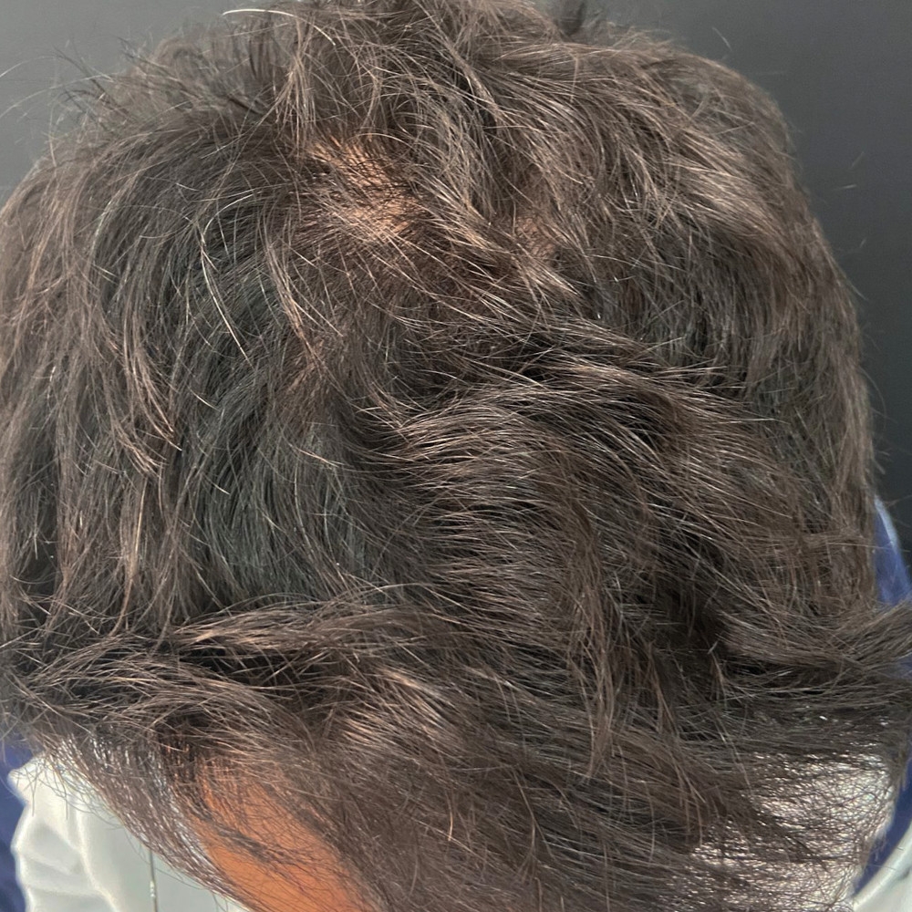 Hair Care Solution Before Image