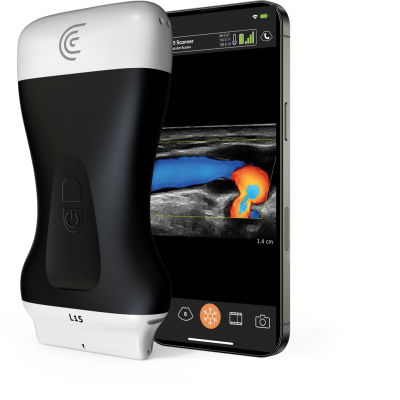 Product-L15-Handheld-Ultrasound-for-Vascular-Access_CMYK_ED