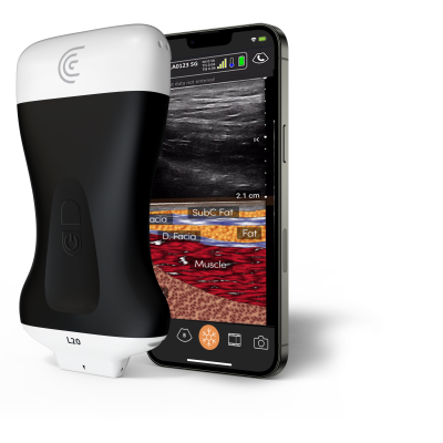 Product-L20-Ultra-High-Freq-Linear-Handheld-Portable-Wireless-Ultrasound-Scanner-MODET copia